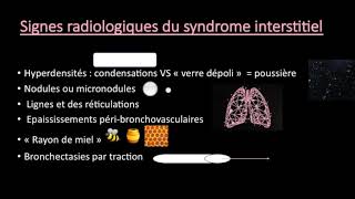 TFR  Différence entre le syndrome alvéolaire et interstitiel à la radiographie [upl. by Wivina]