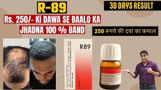 Reckeweg R89 Hair Fall Drops  Homeopathy Treatment For Hair Loss  Hair Fall  Baldness [upl. by Euridice]