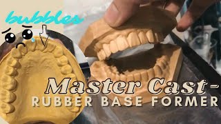 Studentist Diaries🦷 Ep 3 Master Cast Rubber Base Former [upl. by Kcaz]