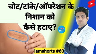 चोटटांकेऑपरेशन के निशान को कैसे हटाए Shorts lamshorts [upl. by Ttayh]