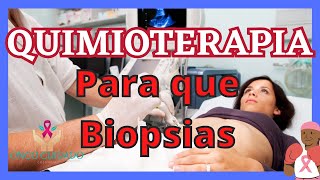 QUIMIOTERAPIA para que biopsias [upl. by O'Donoghue948]