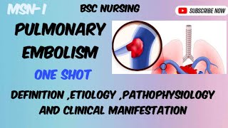 Pulmonary Embolism  part1 Bsc nursing semIII [upl. by Vergos]