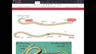 Parasitology Lec 3 Helminths  Ascaris lumbricoides  AlAmeed university [upl. by Catlin]