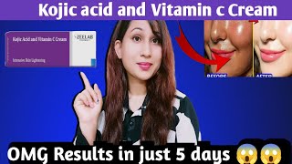 Kojic acid and vitamin c cream honest Review Kojic acid vitamin C creamगोरा करने वाली क्रीम। [upl. by Atnwahs]