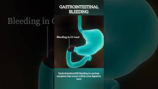 Gastrointestinal Bleeding I Treatment for GI bleed in Delhi Noida [upl. by Ayram]