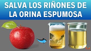 Realice Estos 5 Hábitos Todos Los Días Para DETENER LA PROTEINURIA  Vida Saludable [upl. by Leeland]