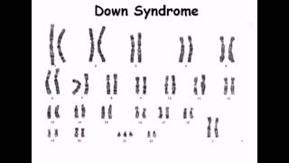 8 Karyotype [upl. by Delbert]