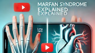 Living With Marfan Syndrome [upl. by Fagen]