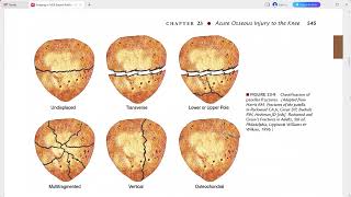 RADIOLOGY EXAM CASES [upl. by Laurena]