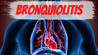 Bronquiolitis en el Adulto [upl. by Naahs]