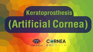 Cornea Colours  Keratoprosthesis Artificial Cornea [upl. by Gerrald233]