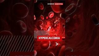 Hypercalcemia Key Facts You Should Know hypercalcemia [upl. by Albrecht]