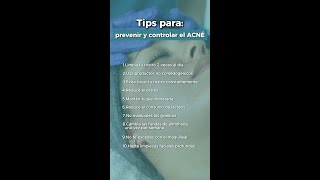 TIPS PARA CONTROLAR Y PREVENIR EL ACNÉ [upl. by Dodge473]