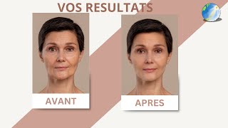 Résultats AVANT APRES avec le programme du rajeunissement du visage [upl. by Alisan]