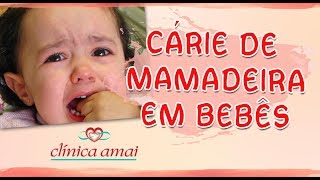 Cárie de Mamadeira em Bebês e Crianças com Dra Carmem Silvia da Clinica Amai [upl. by Eiba443]