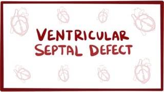 Ventricular septal defect VSD  repair causes symptoms amp pathology [upl. by Yliah503]