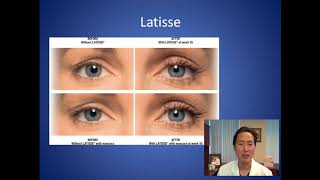 How Can I Make My Eyelashes Thicker and Longer  Latisse Consultation  Dr Anthony Youn [upl. by Ardnuhs]