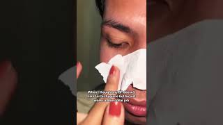 It felt so good unclogging those pores 🫠 porestrip blackheadremoval satisfying [upl. by Dleifniw]