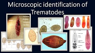 Microscopic identification of Trematodes [upl. by Nomaj]