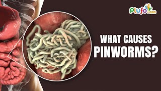 What Causes Pinworms  Pinworm Symptoms  Best Learning Videos For Kids  Plufo [upl. by Enelrae]