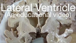 LATERAL VENTRICLE  BOUNDARIES An educational video [upl. by Fahy14]