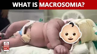 What is Macrosomia [upl. by Lamoree]