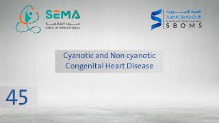 Cyanotic and non cyanotic Congenital heart disease  الدكتور أنس سلقيني [upl. by Lledyl]