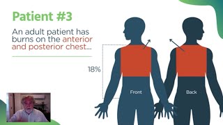 Rule of 9s Practice for EMTs Calculating Burn Surface Area [upl. by Drofub]