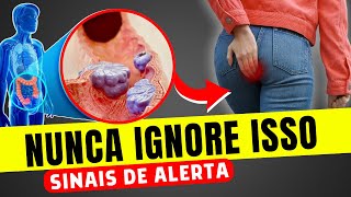 SINTOMAS de ALERTA de CÂNCER DE INTESTINO que você NUNCA PODE IGNORAR [upl. by Enair]