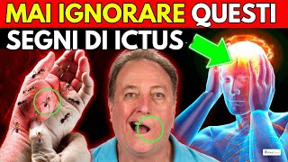 SEGNI PRECOCI di EMORRAGIA cerebrale ed ICTUS [upl. by Balling864]