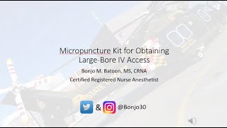 Micropuncture kit for largebore venous access [upl. by Noned]