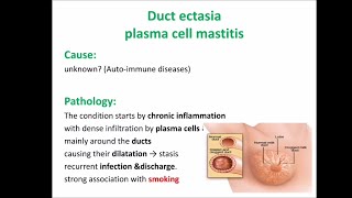 Mammary duct ectasia [upl. by Seton577]