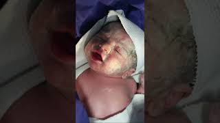 My newborn baby with Vernix Caseosa Just after birth cutebabyboy baby babyborn newbornbaby [upl. by Arutnev]