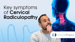 Key Symptoms of Cervical Radiculopathy  Expert Physio Guide [upl. by Desdemona]