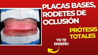 Placas bases rodetes de oclusión y contorno 👅 PASOS Prácticos ProtesisTotales [upl. by Santa]