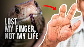 How to Survive The Most Dangerous Snake Bites  Part 2 [upl. by Webster]