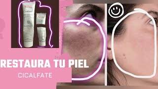 Mi Experiencia Reparando mi piel Irritada y Seca con Cicalfate de Avene [upl. by Nnyladnarb459]