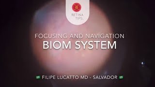 Improving visualization using BIOM system in vitreoretinal surgery [upl. by Dieball62]