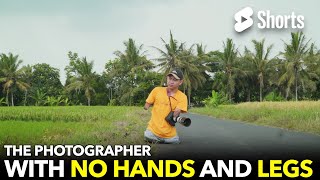 The Photographer With No Hands And Legs 146 [upl. by Ajssatsan]