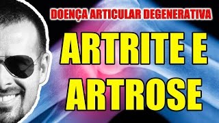 Artrite e Artrose  Doença Articular Degenerativa  Anatomia Humana  Articulações  VideoAula 085 [upl. by Eelamme623]