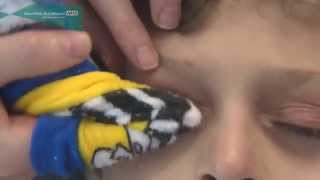 How to clean the eyelids in children and babies [upl. by Eddy]