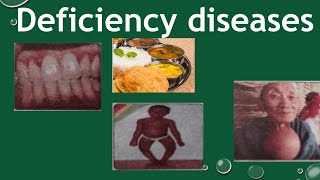 Deficiency diseases components of Food  deficiency diseases class 6 [upl. by Elleined702]