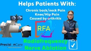 Radiofrequency Nerve Ablation RFA  Back and Neck Pain Treatment [upl. by Maryn]