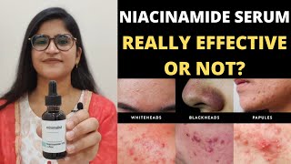 Niacinamide serum 10  ZincReally Effective Or NotNiacinamide skin benefits [upl. by Akemor]