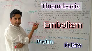 Thrombosis and Embolism  Biology class 11  Dr Mushtaq Pashto Lectures [upl. by Lezti264]