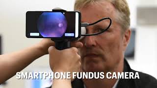 Smartphone Fundus Camera [upl. by Sorcha]