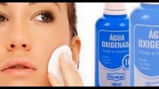 9 Formas De Usar El Agua Oxigenada Para Conseguir Un Rostro Hermoso [upl. by Bazluke843]