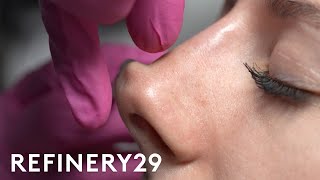 I Tried A NonSurgical Nose Job  Macro Beauty  Refinery29 [upl. by Ellezig]