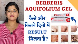 Berberis Aquifolium Gel for Acne and Scars ॥ कैसे और कितने दिनो में Result मिलता है [upl. by Nylzor984]