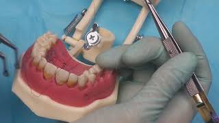 Suturas em Manequim  Cirurgia periodontal [upl. by Orferd]